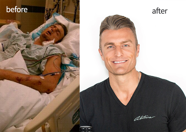 Side-by-side comparison of a man in hospital bed and a smiling man with gray hair in black shirt.