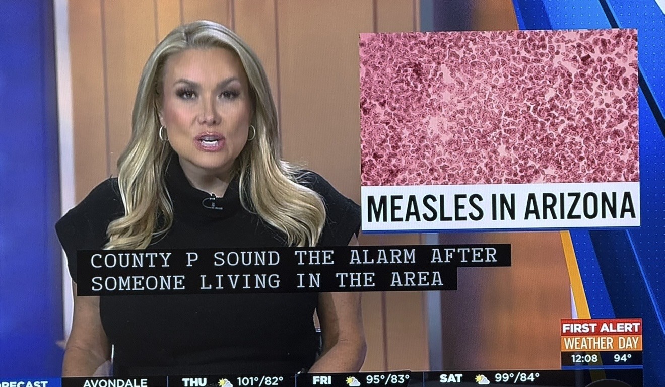 News anchor with blonde hair reports on measles in Arizona, with a pink microscopic image and a weather update banner.